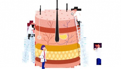 特应性皮炎是怎么回事儿？