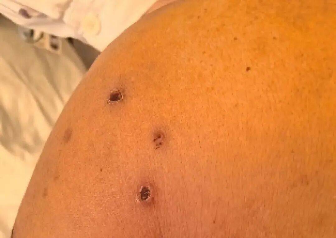 深圳一市民突遭马蜂围袭!已进入高发期,千万别招惹!